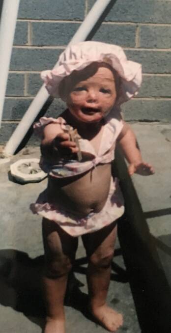 SURVIVOR: Jessie Wadley when she was a toddler. Picture: Supplied