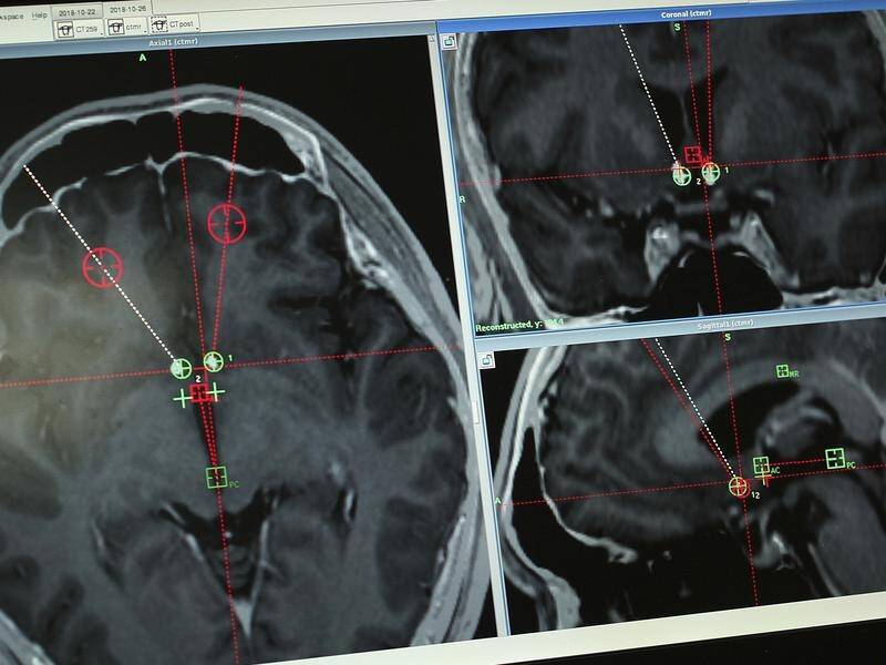 Doctors can now make deep brain stimulation therapy adjustments from anywhere in the world.
